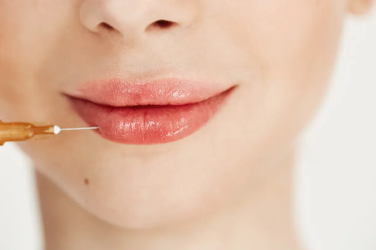 آیا بعد از تزریق فیلر لب می‌توانم رژ لب بزنم؟
